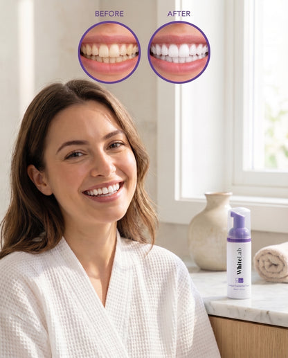 V-Blanc Whitening Schaum